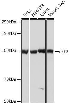 eEF2 Rabbit monoclonal antibody