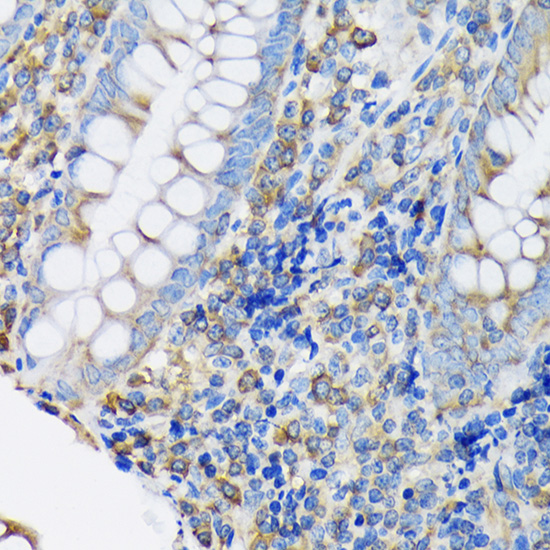 eEF2 Rabbit monoclonal antibody