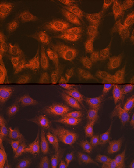 eEF2 Rabbit monoclonal antibody