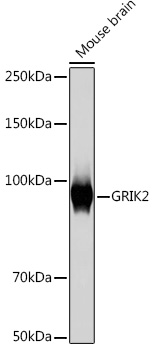 GRIK2 Rabbit monoclonal antibody