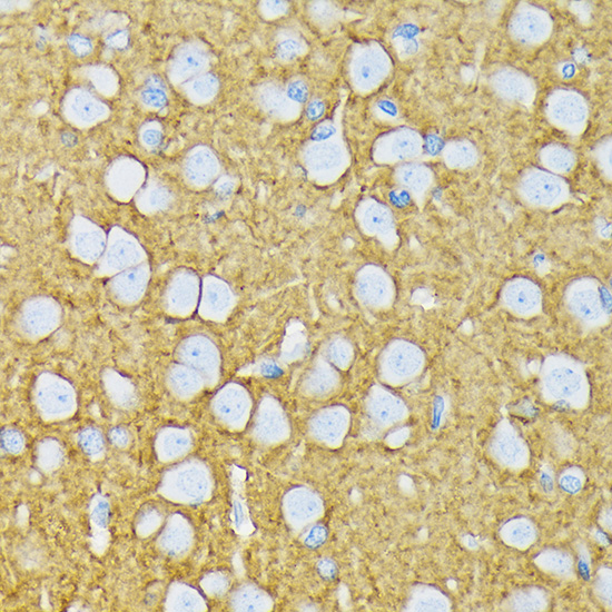 GRIK2 Rabbit monoclonal antibody
