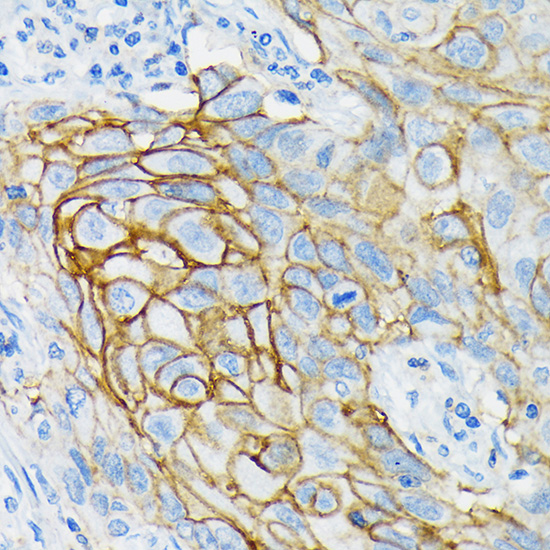 GRIK2 Rabbit monoclonal antibody
