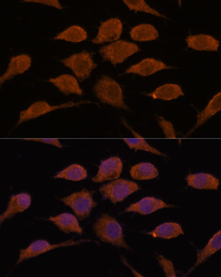 USP19 Rabbit polyclonal antibody
