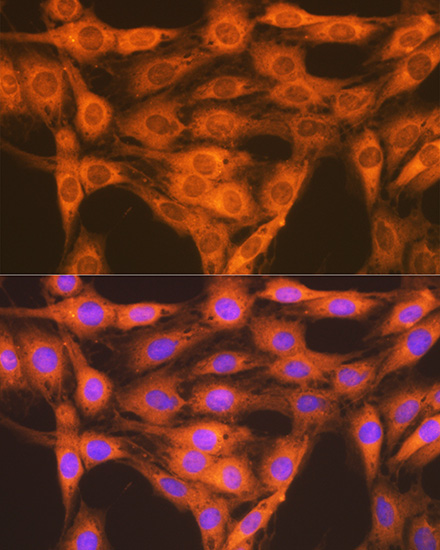 RAP1A + RAP1B Rabbit monoclonal antibody