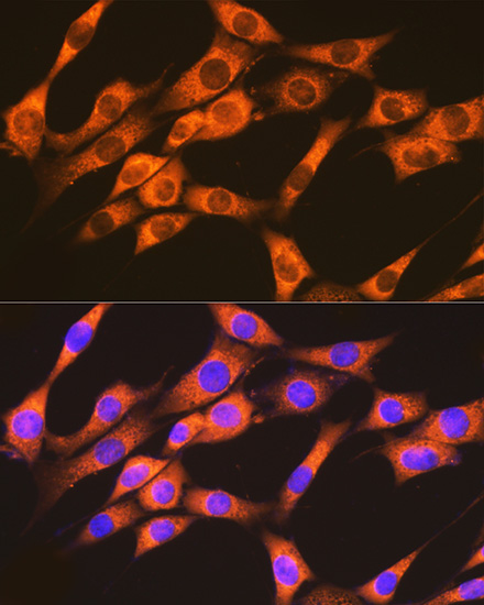 RAP1A + RAP1B Rabbit monoclonal antibody