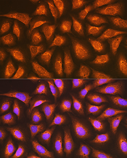 RAP1A + RAP1B Rabbit monoclonal antibody