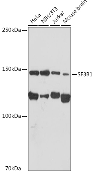SF3B1 Rabbit monoclonal antibody