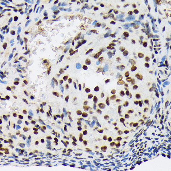 SF3B1 Rabbit monoclonal antibody