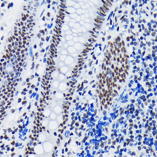 SF3B1 Rabbit monoclonal antibody
