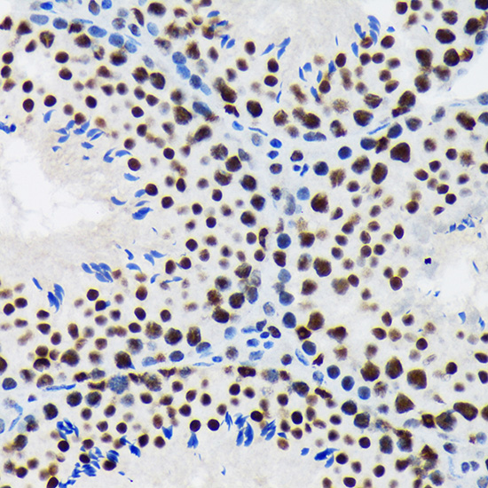 SF3B1 Rabbit monoclonal antibody
