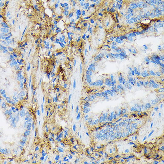 Collagen VI/COL6A1 Rabbit monoclonal antibody