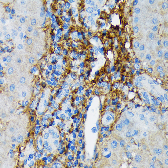 Collagen VI/COL6A1 Rabbit monoclonal antibody