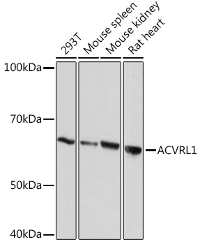 ACVRL1 Rabbit monoclonal antibody