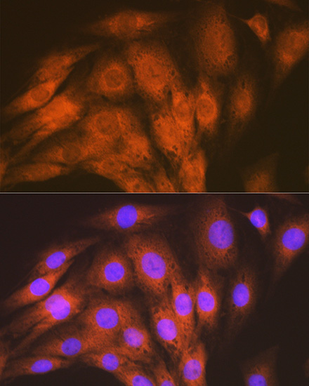 ACVRL1 Rabbit monoclonal antibody