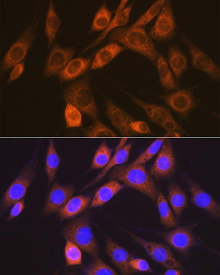 ACVRL1 Rabbit monoclonal antibody