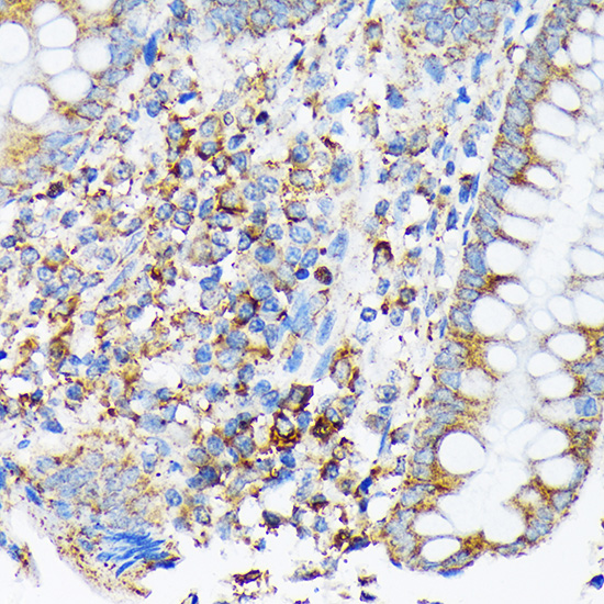 CDC25B Rabbit monoclonal antibody
