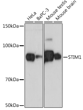 STIM1 Rabbit monoclonal antibody