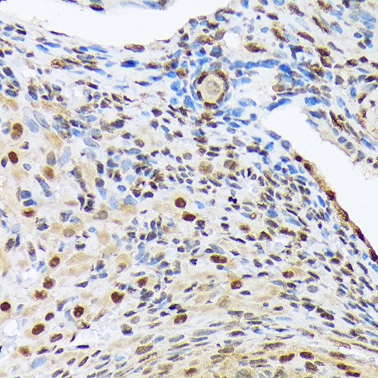 HES5 Rabbit monoclonal antibody