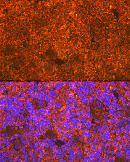 CD3D Rabbit monoclonal antibody