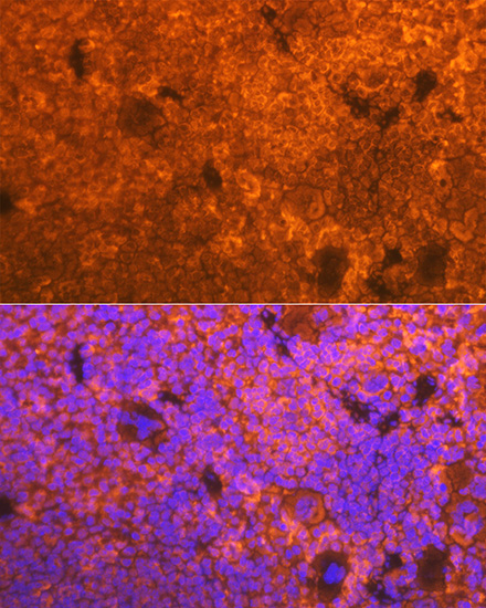 CD3D Rabbit monoclonal antibody