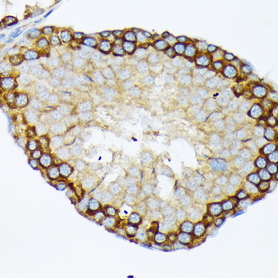 USP9X Rabbit monoclonal antibody