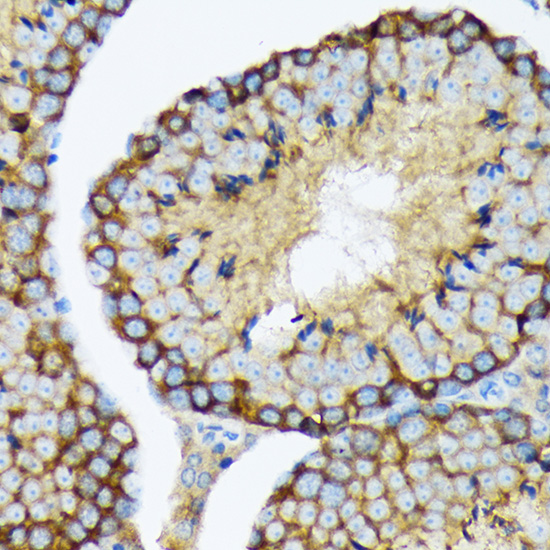 USP9X Rabbit monoclonal antibody