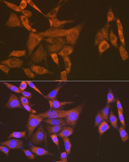 USP9X Rabbit monoclonal antibody