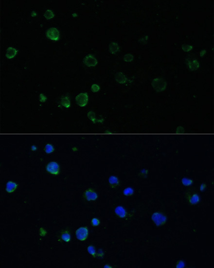 PMAIP1 Rabbit polyclonal antibody
