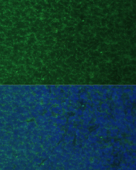PMAIP1 Rabbit polyclonal antibody