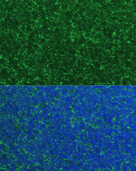 PMAIP1 Rabbit polyclonal antibody