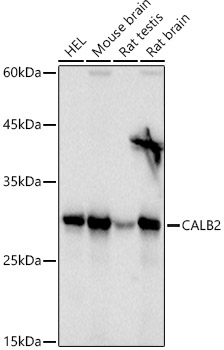 Calretinin Rabbit polyclonal antibody