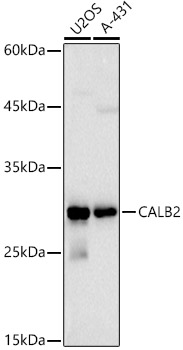 Calretinin Rabbit polyclonal antibody