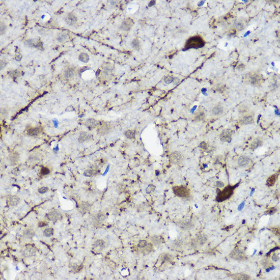 Calretinin Rabbit polyclonal antibody