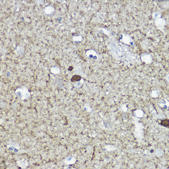 Calretinin Rabbit polyclonal antibody