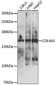 COL4A5 Rabbit polyclonal antibody