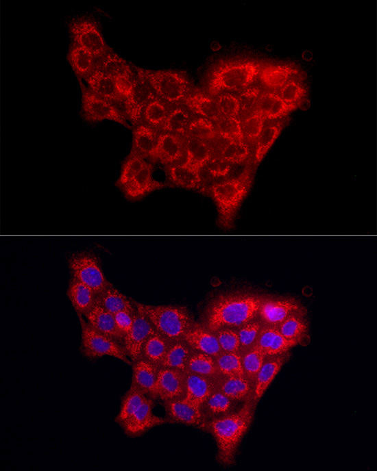 COL4A5 Rabbit polyclonal antibody