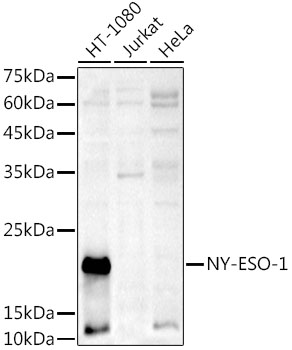 NY-ESO-1 Rabbit polyclonal antibody