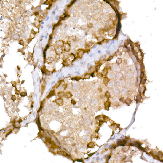 NY-ESO-1 Rabbit polyclonal antibody