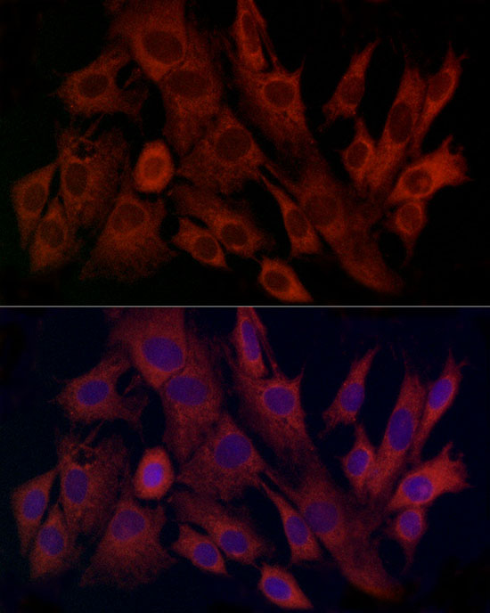 TIMM8A Rabbit polyclonal antibody