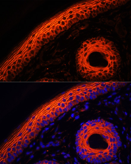 DSG1 Rabbit polyclonal antibody
