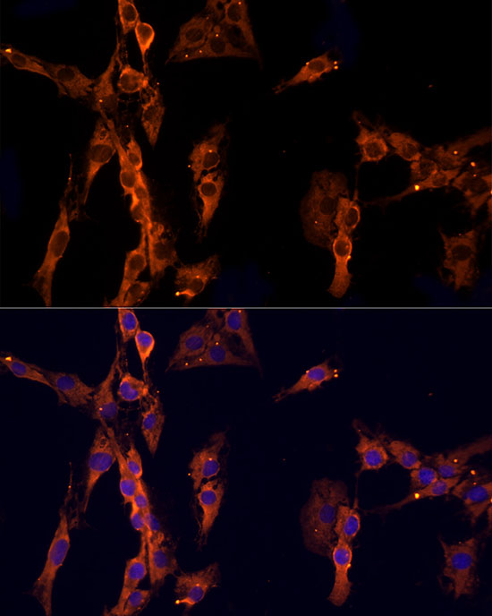 EPS15 Rabbit polyclonal antibody