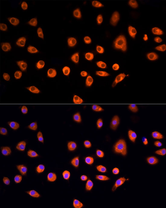 EPS15 Rabbit polyclonal antibody