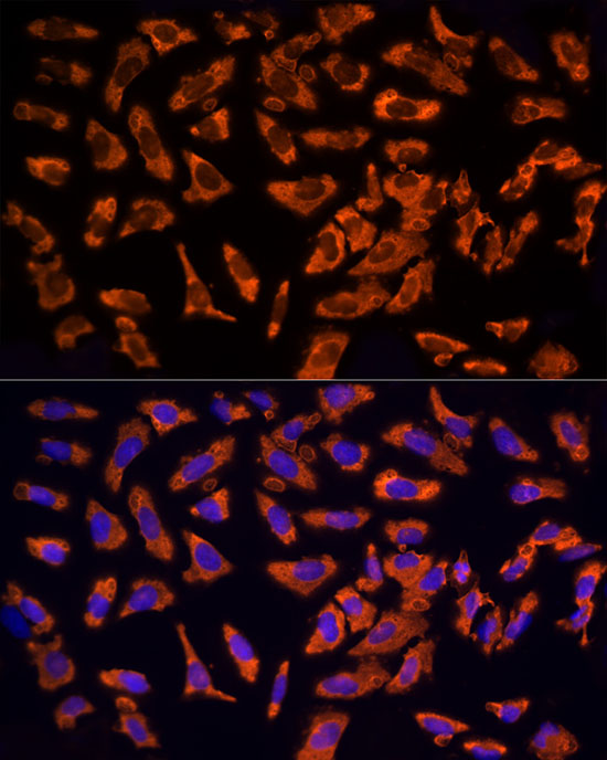 EPS15 Rabbit polyclonal antibody