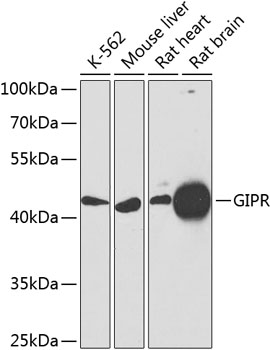 GIPR Rabbit polyclonal antibody