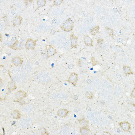 GIPR Rabbit polyclonal antibody