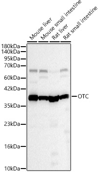 OTC Rabbit polyclonal antibody