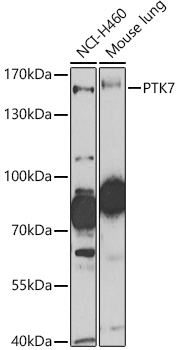 PTK7 Rabbit polyclonal antibody