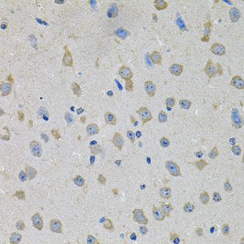 PTK7 Rabbit polyclonal antibody