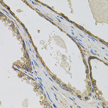 PTK7 Rabbit polyclonal antibody