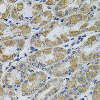 PTK7 Rabbit polyclonal antibody